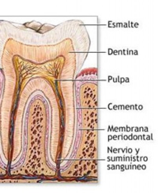 cemento