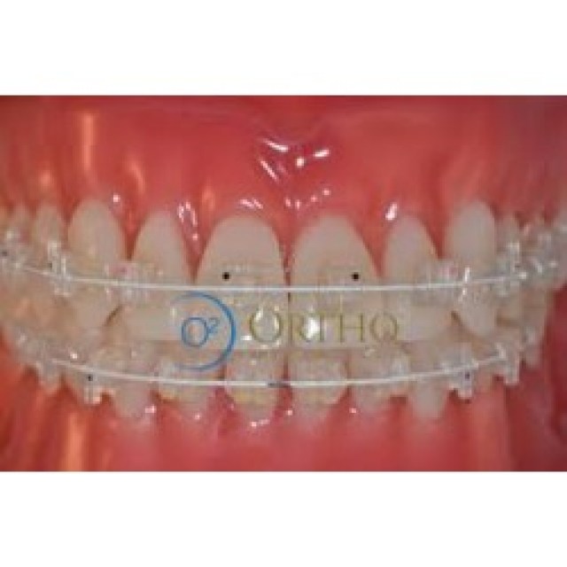 brackets-ceramico-022-p-mbt